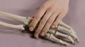 Ilustrasi osteoporosis. (Foto: Pexels)