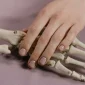 Ilustrasi osteoporosis. (Foto: Pexels)